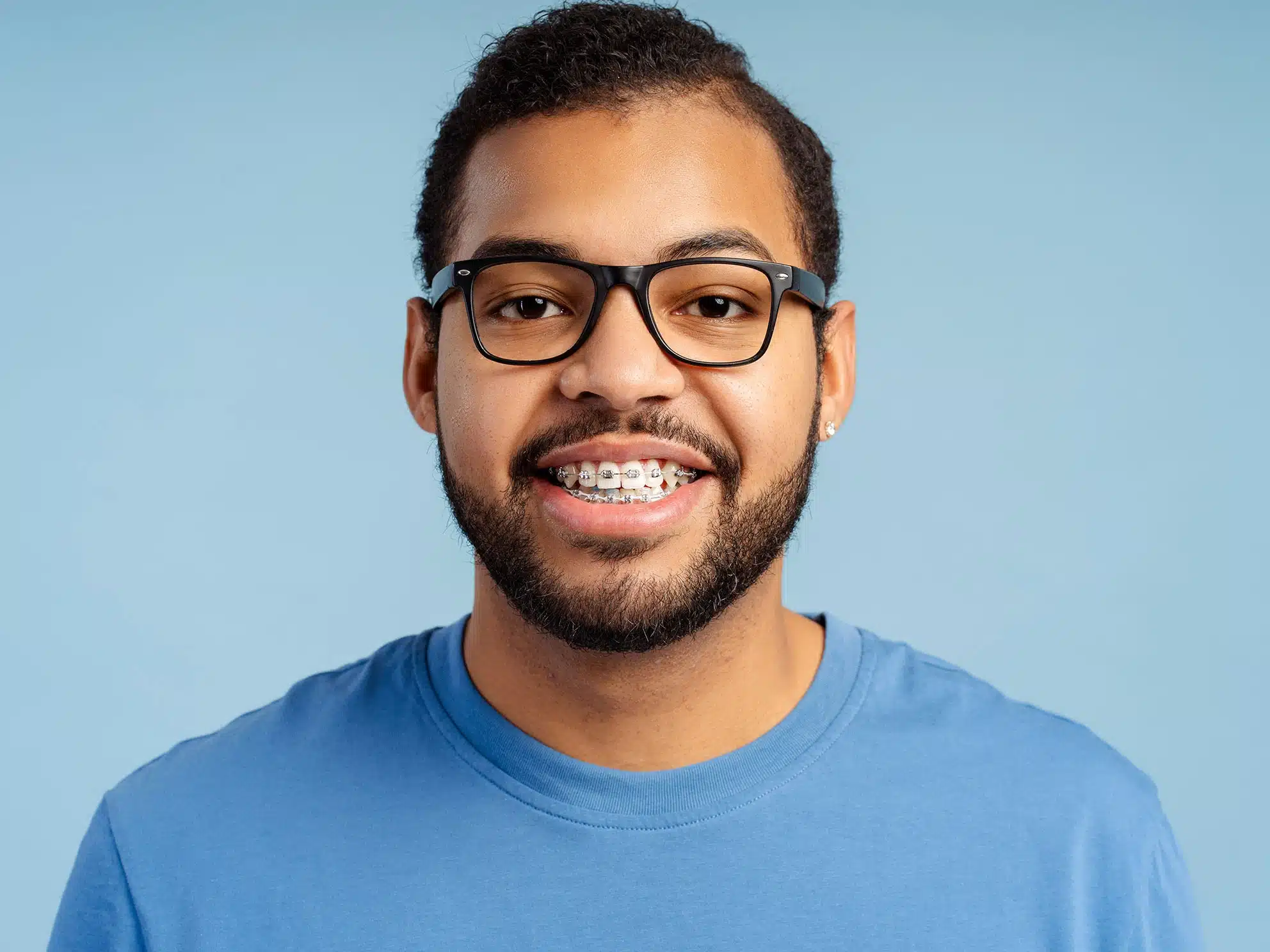 Braces-and-Aligners-Imge